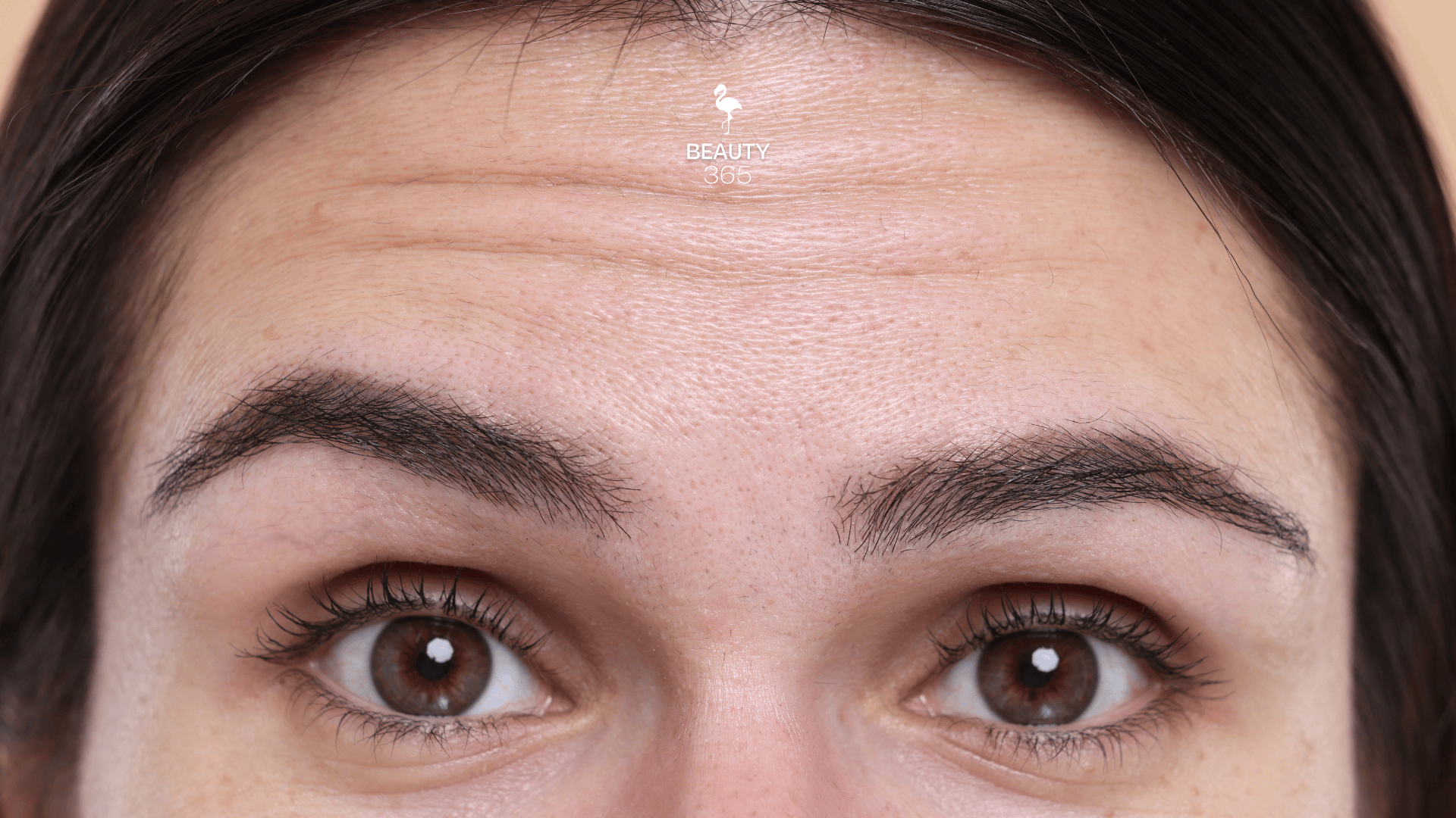 Botox Preventivo: Quando Começar? Guia Completo para Mulheres Acima de 40 Anos