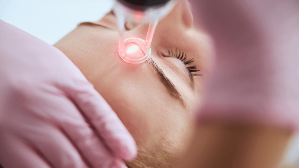 Laser Lavieen em Londrina