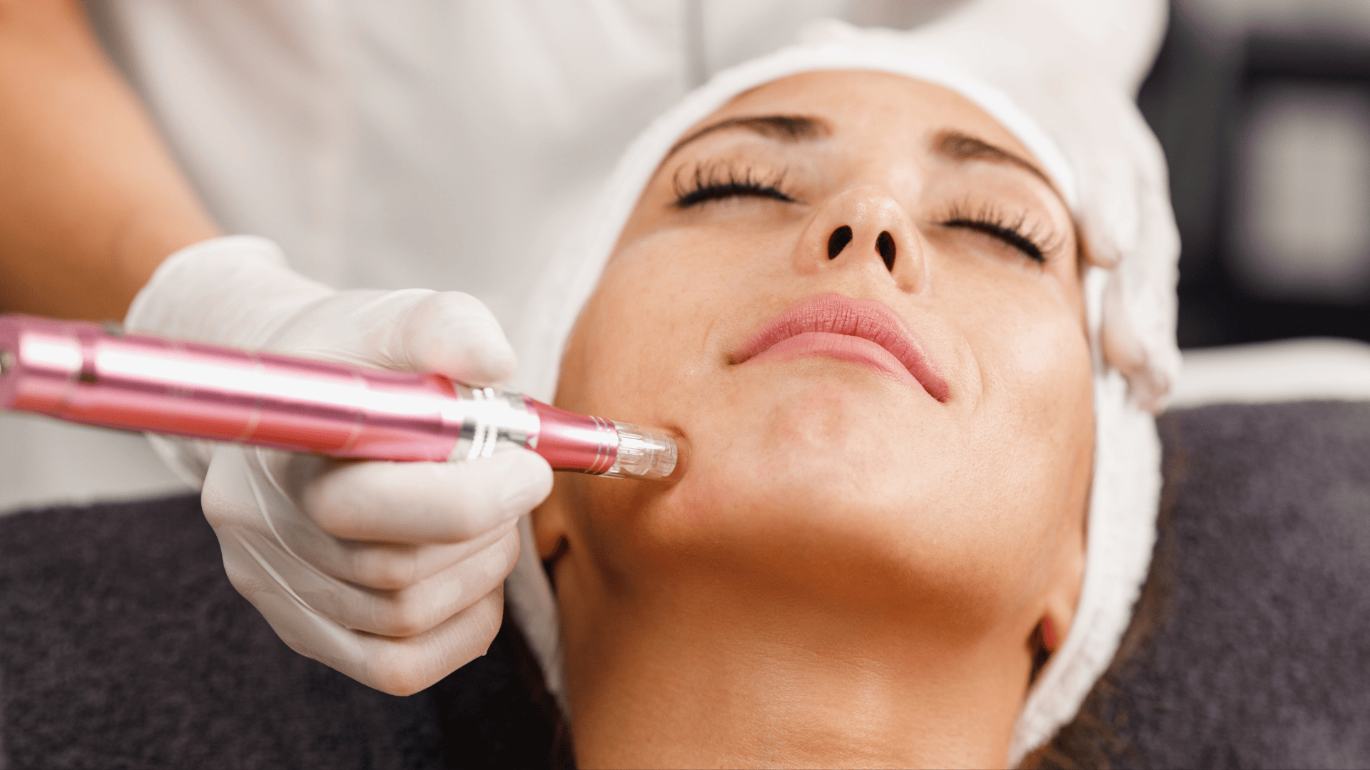 PDRN Facial em Londrina