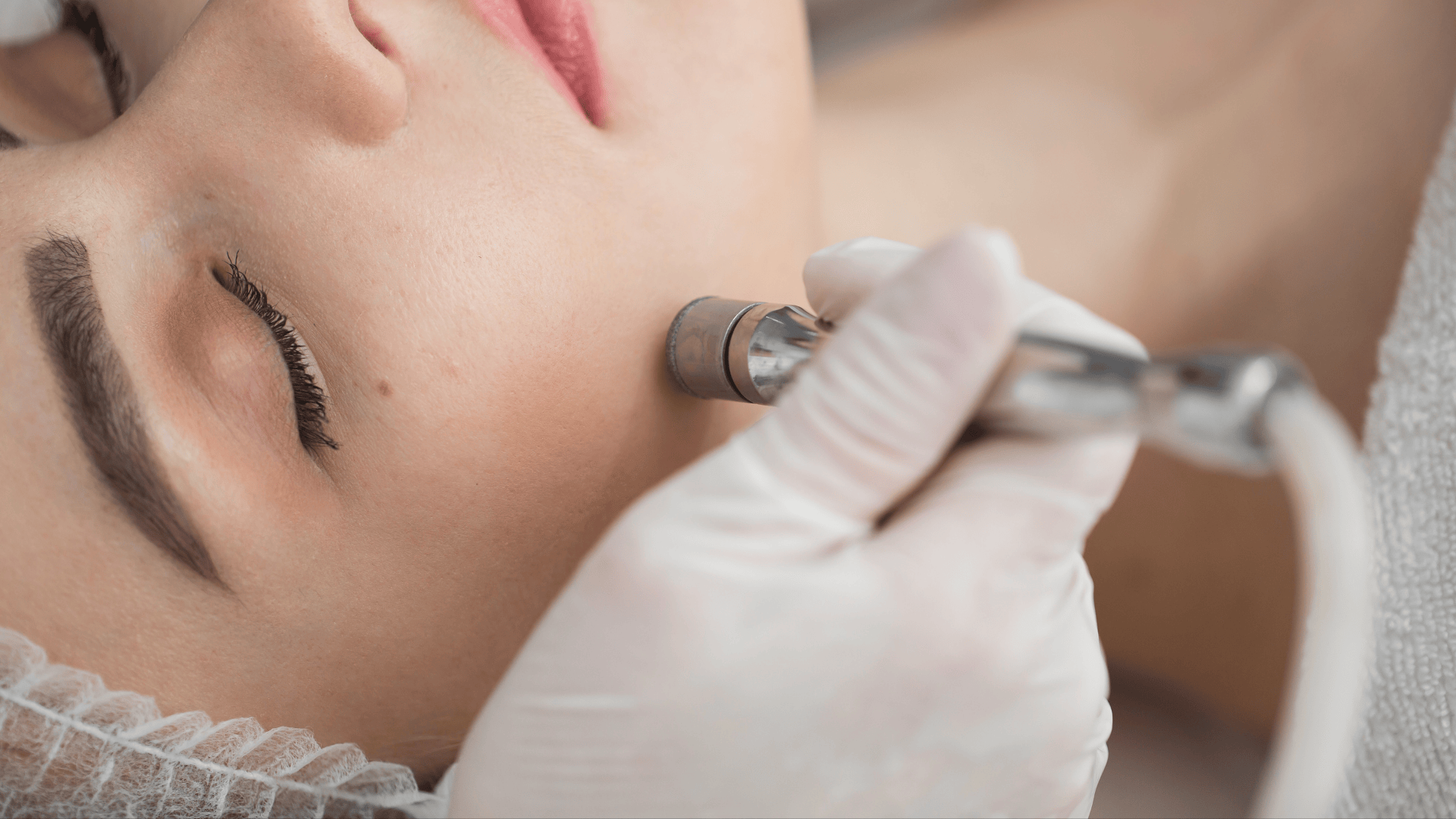 Peeling de Diamante em Londrina