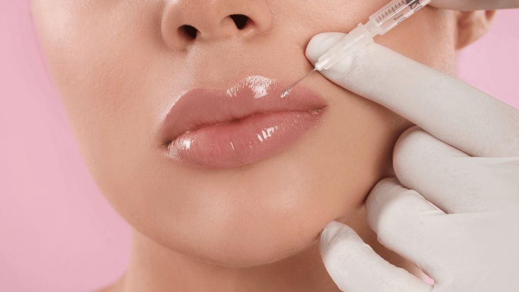 Preenchimento Labial em Londrina