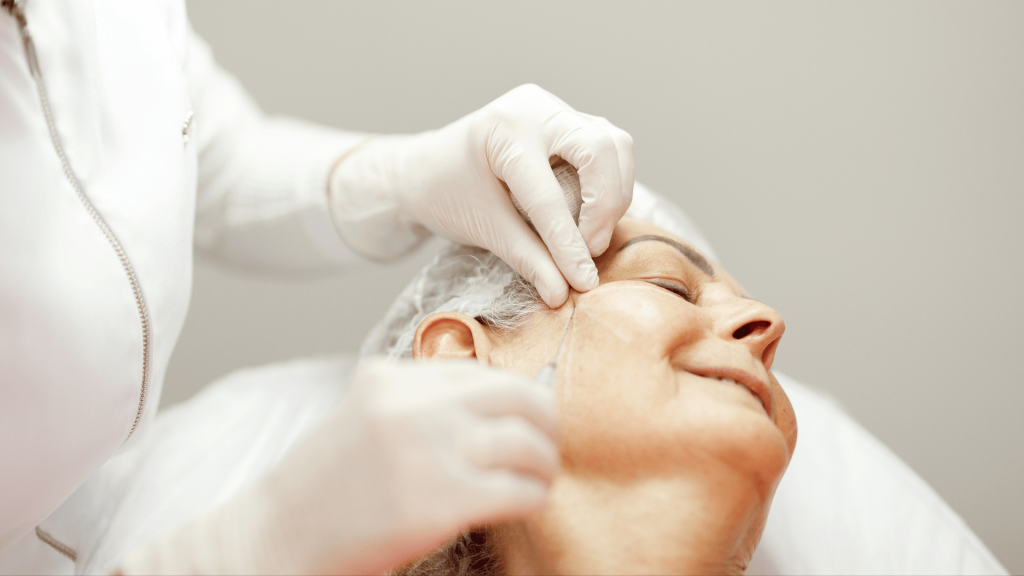 Radiesse Facial em Londrina