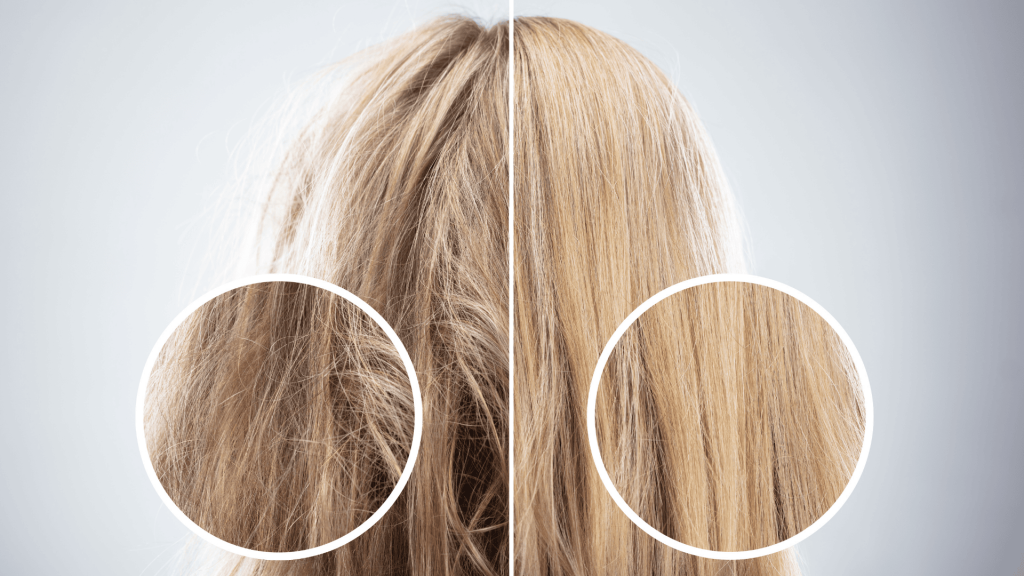 Reconstrução L’Oréal