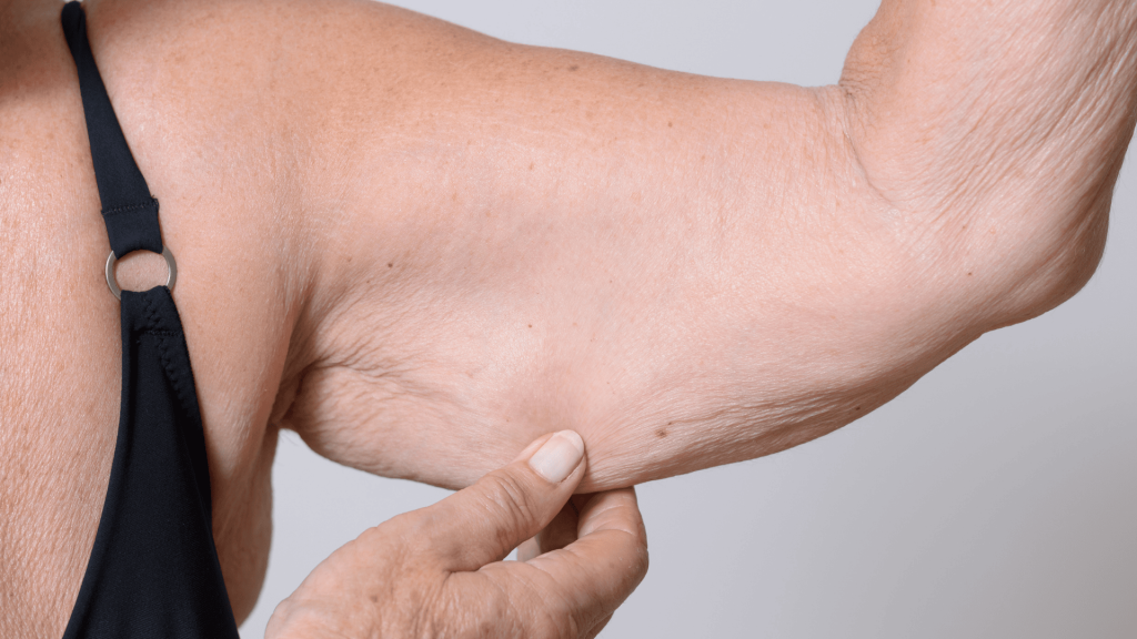 Tratamento para Flacidez Corporal em Londrina