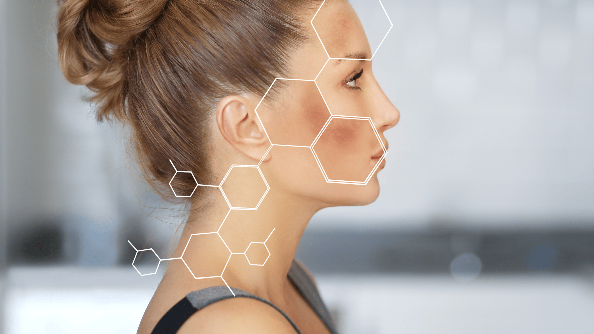 Melasma e manchas na pele entenda as diferenças e como tratar