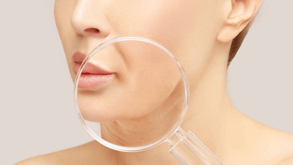 Bigode chinês: como suavizar os sulcos e rejuvenescer o rosto