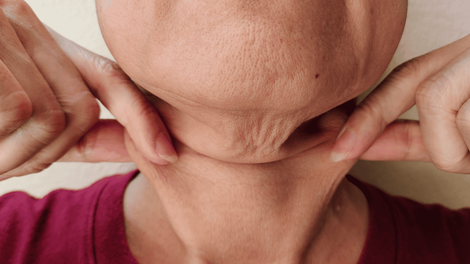 Flacidez no rosto: os melhores tratamentos para recuperar a firmeza da pele