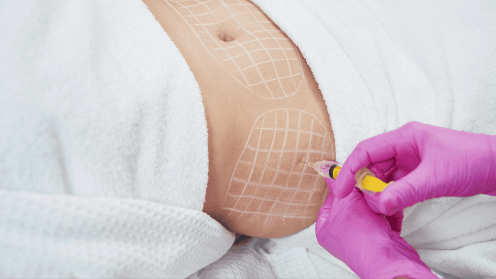 Hidrolipoclasia Não Aspirativa em Londrina