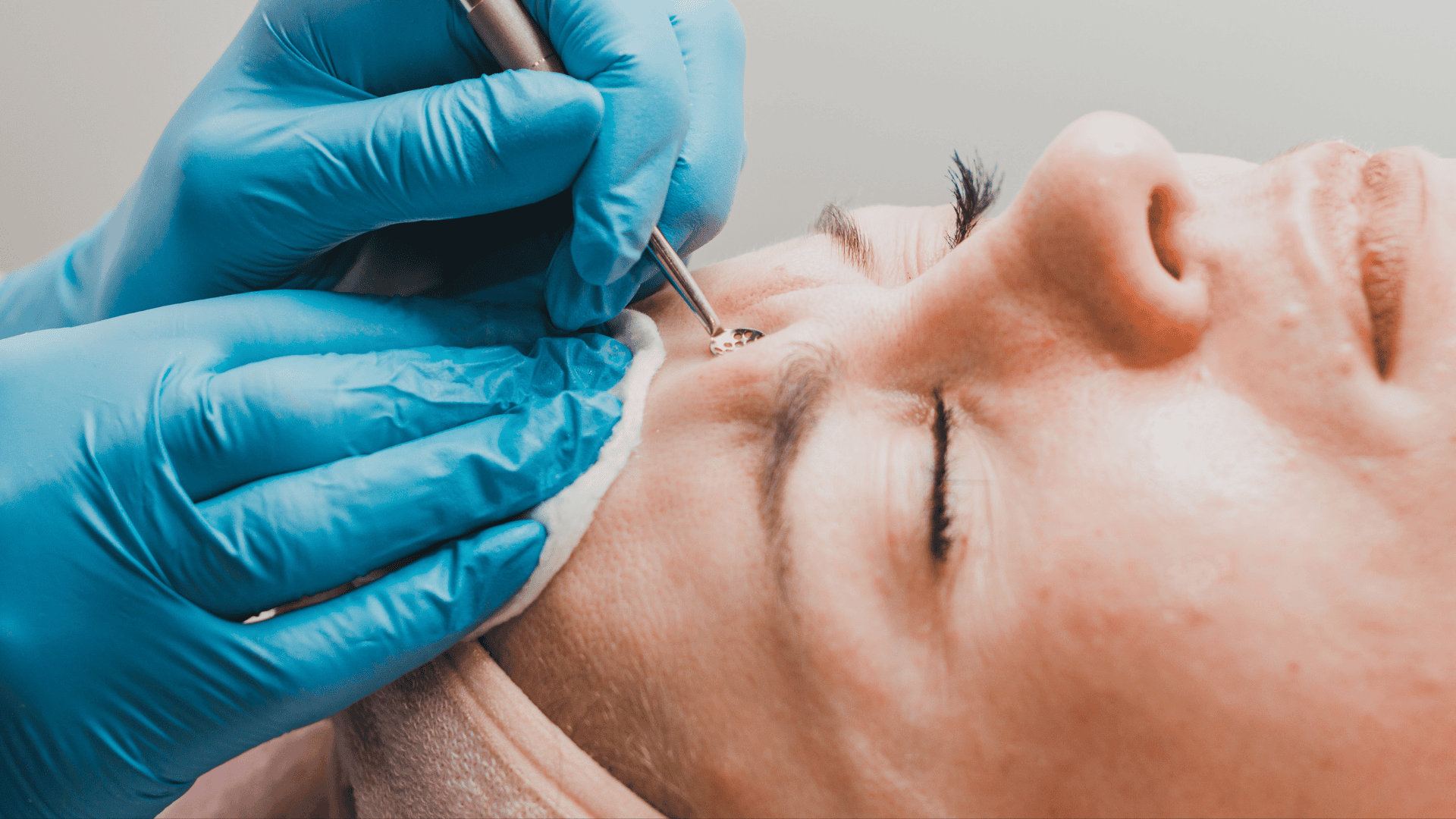 Limpeza de pele profunda em Londrina: descubra o segredo da pele limpa e saudável